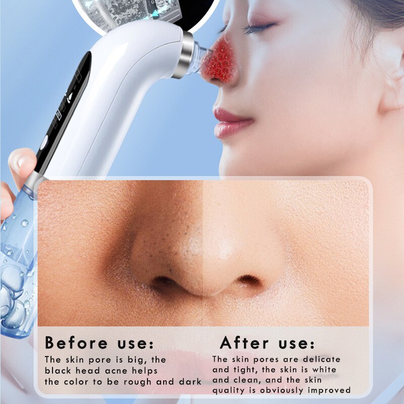 Penghilang Komedo Wajah Pembersih Hidung Dalam Water Cycle Acne Penghilang Jerawat Vacuum Suction Facial Diamond Beauty Clean Skin Tool