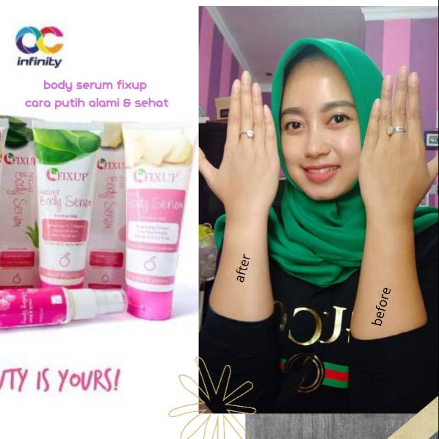 1 PAKET FIXUP BODY SERUM BODY LOTION PEMUTIH KULIT