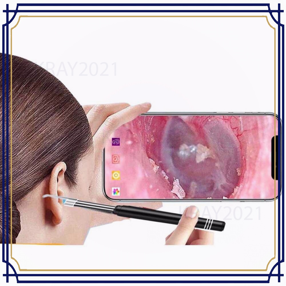 Kamera Endoscope HD USB Medical Earpick 30W 5.5mm - JC40