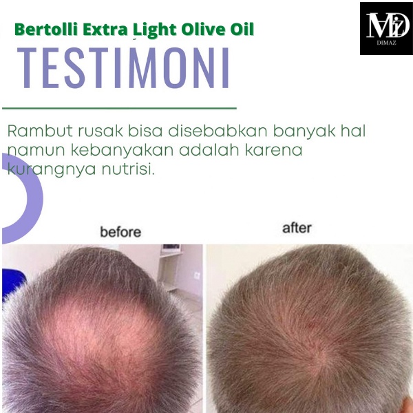 penumbuh rambut penumbuh rambut botak obat penumbuh rambut penumbuh rambut botak dan rontok