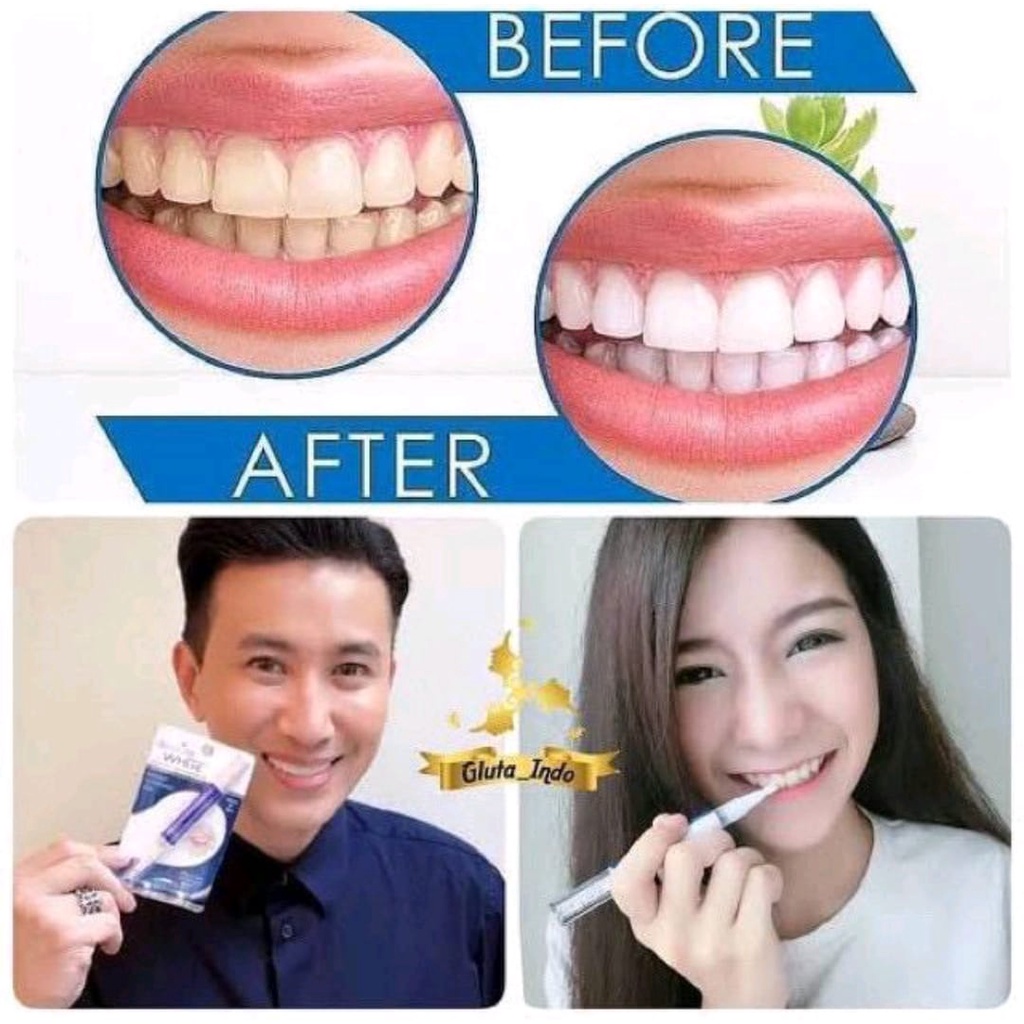 Pemutih Gigi Instant Dazzling White Teeth Whitening Pen Gel 100% Original Dazling / Pemutih Gigi Bahan Gel Peroksida Teeth Whitening Rotary Peroxide Gel Too / Pemutih Pasta Gigi Kuning Permanen Pemutih Kuas Gigi Ampuh Instant Whitening