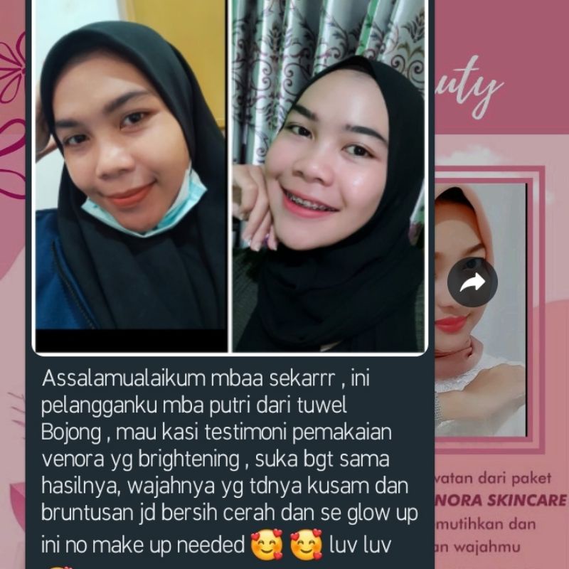 VENORA SKINCARE TERLARIS READY STOCK ! PENGHILANG JERAWAT . PEMBERSIH PENGHILANG JERAWAT .BIKIN GLOWING , BEBAS FLEK HITAM