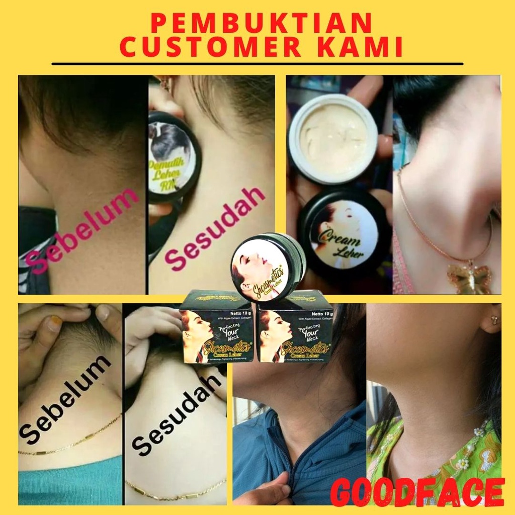 CREAM LEHER SH COSMETICS ORIGINAL BPOM PERONTOK DAKI PEMUTIH KULIT PEMUTIH BADAN PERMANEN PEMUTIH KETIAK PERAWATAN TUBUH CREAM KETIAK