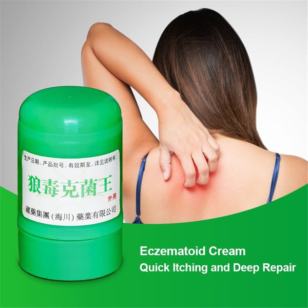 Skin Psoriasis Eczma Cream Herbal Antibacterial Ointment Skin Care Antibacterial Cream for All Kinds