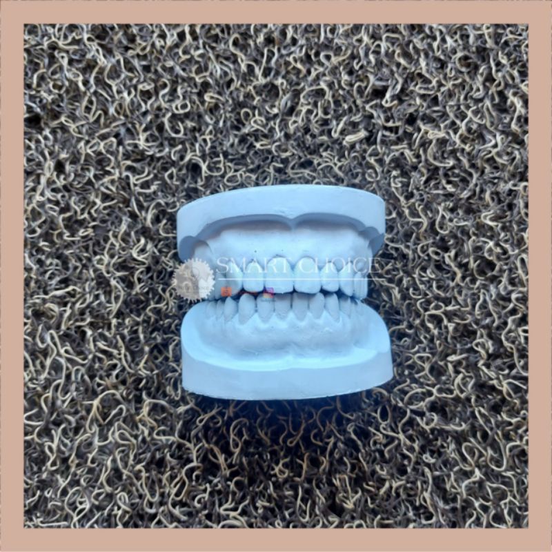 Dental Model Study gips / model gigi gips / model study gipsum gypsum pratikum