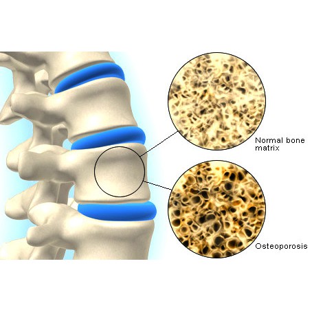 KALSIUM MAGNESIUM with Vitamin D3 USA IMPOR
