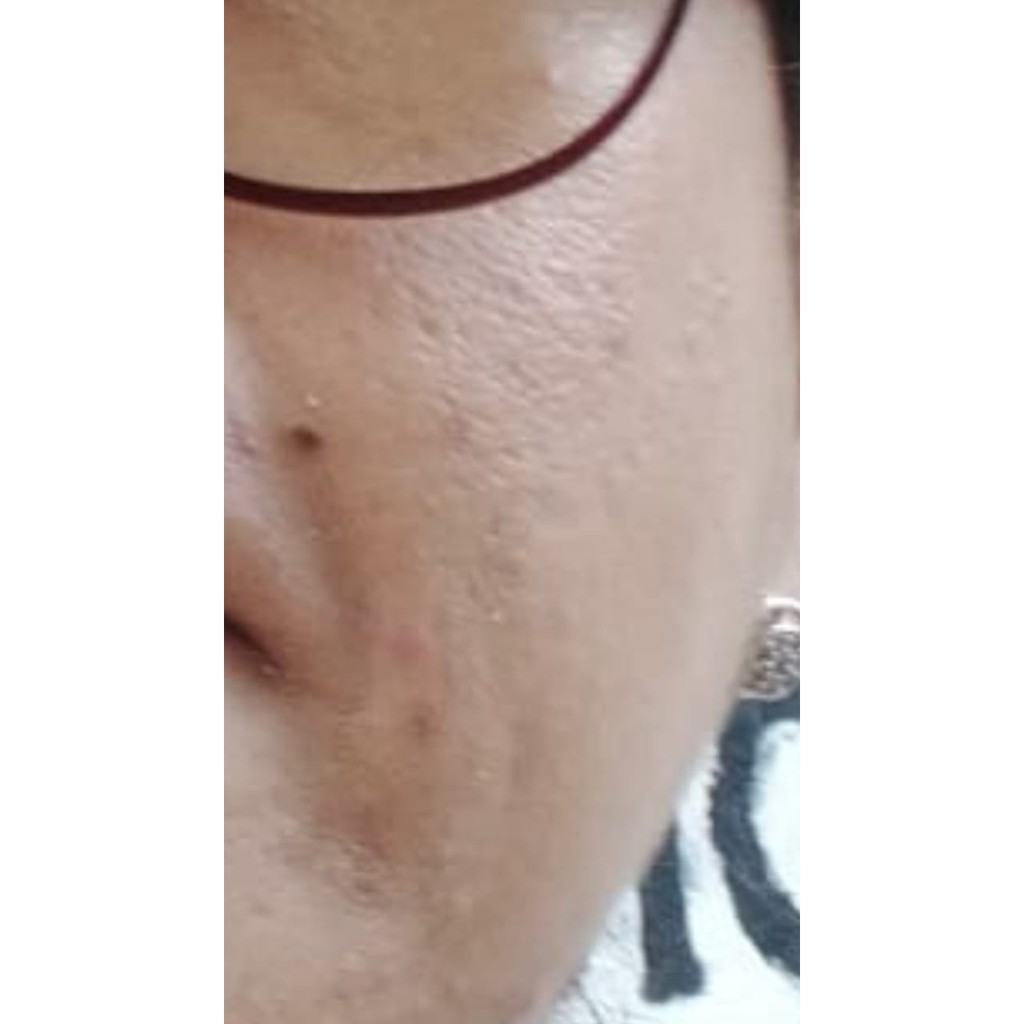 REGLOW Paket Skincare Original Asli | Perawatan Kecantikan Wajah Glowing | Glow Skin Treatment | Atasi Muka Jerawat Flek Hitam Milia Kusam | Skin Care BPOM Halal MUI | Sunscreen Whitening Anti-Aging | Aman Bumil Busui-4