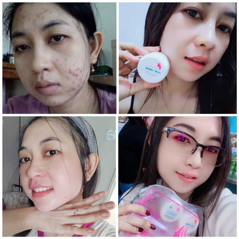 Nahda Skincare | Nahda Skincare 100% Original | Nahda Skincare BPOM | Nahda Skincare Paket Glow Acne & Glow Normal-5