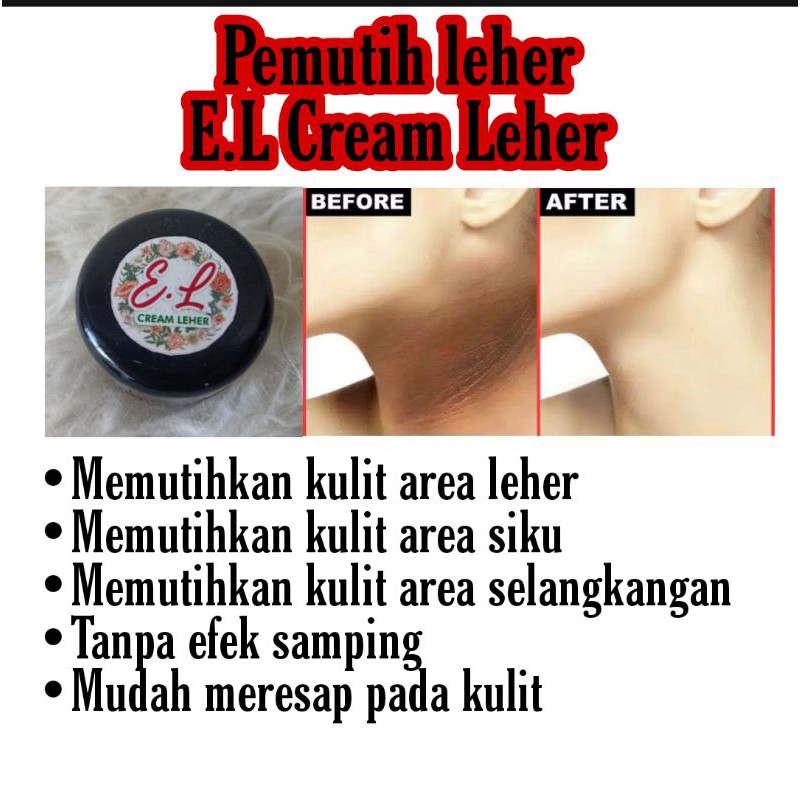 E.L Cream pemutih leher dan siku paling ampuh cepat dan original