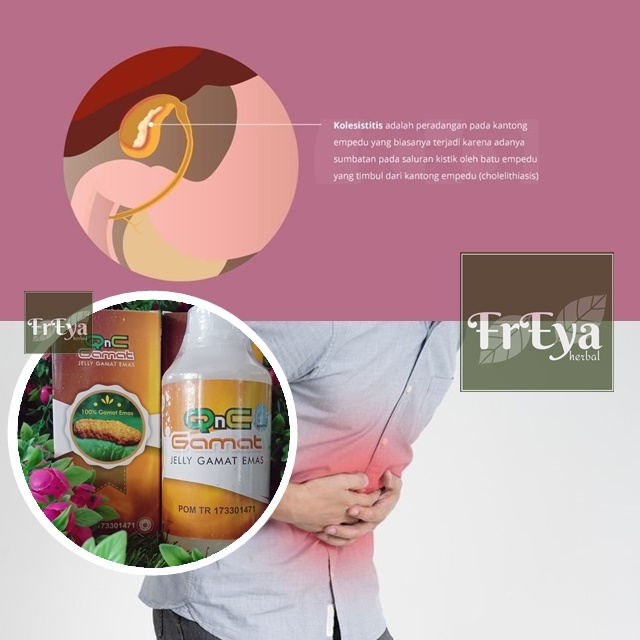 OBAT KOLESISTITIS, OBAT HERBAL RADANG KANTUNG EMPEDU, OBAT RADANG EMPEDU, OBAT INFEKSI EMPEDU (BISA 