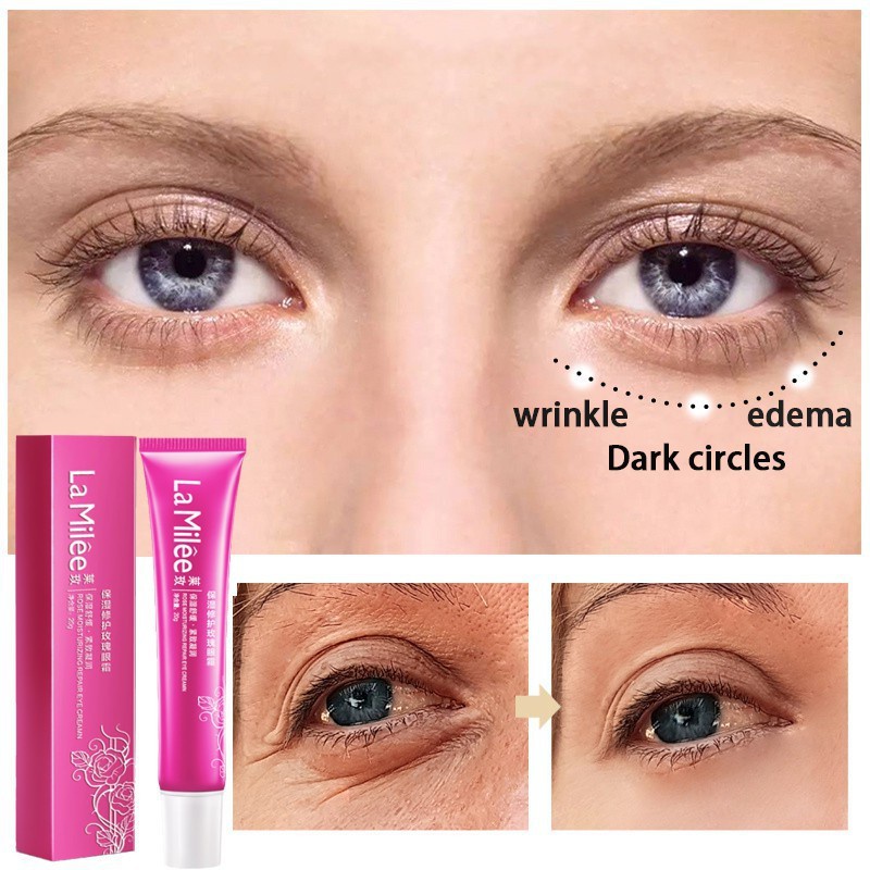 Eye Cream Eye Serum 20g Meringankan Lingkaran Hitam/Kerutan Mata/Pelembab Mencerahkan/Mengencangkan Area Mata