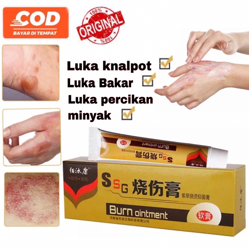Jual Salep Obat Oles untuk luka bakar, luka bernanah, luka kulit panas