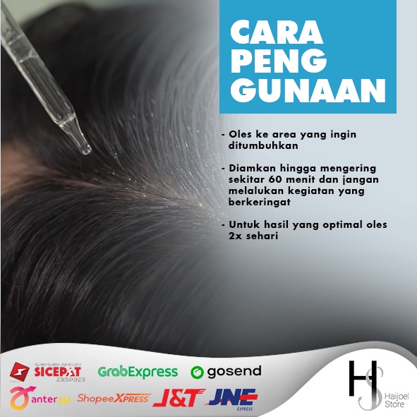 Minoxidil Kirkland Penumbuh Brewok dan Kebotakan Rambut