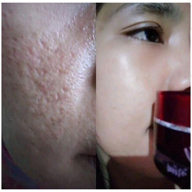 (✓COD) RK RED JELLY PREMIUM RKGLOW KOSMETIK VIRAL FLEK JERAWAT AGEN