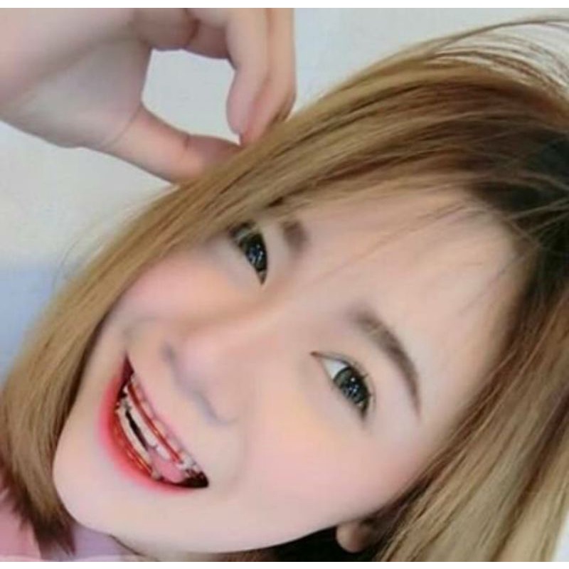 Behel thailand/behel lepas pasang/behel