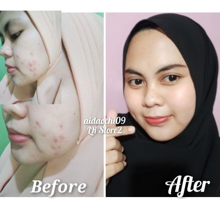 Ready K6YAK CREAM NATURE GLOW PREMIUM KRIM JERAWAT CREAM ACNE FLEK HITAM KRIM KULIT KUSAM CREAM AMAN