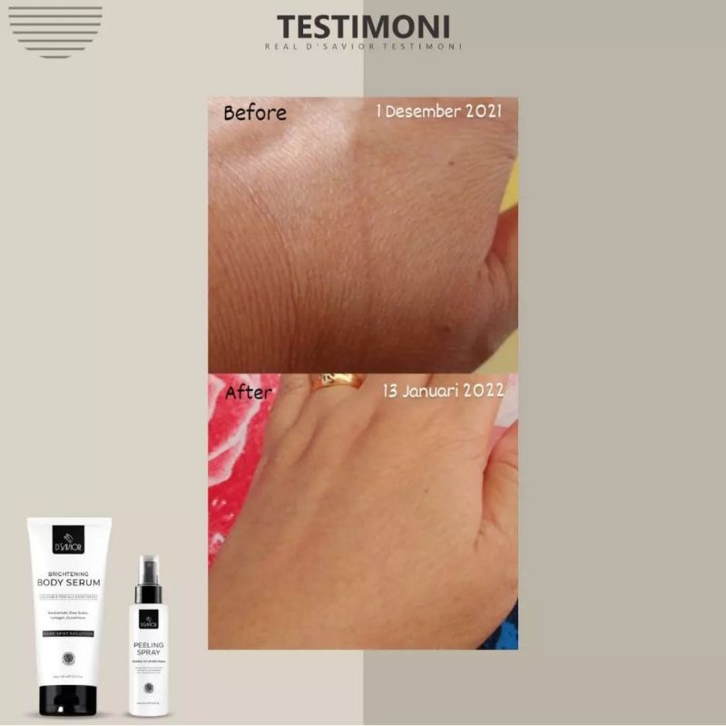 DSavior Body Whitening [Jaminan Original] Lotion Pencerah Badan Original BPOM D Savior Dark Spot Serum Lotion Pemutih Badan Ampuh Permanan Penghilang Bekas Luka Bpom