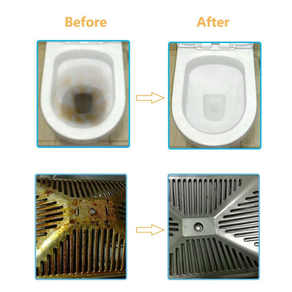 Pembersih WC Toilet Penghilang Kerak Membandel Ring X Pumice  As Seen On Tv Menghilangkan CHS-0838