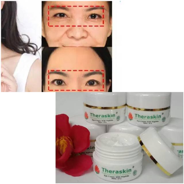 theraskin eye cream