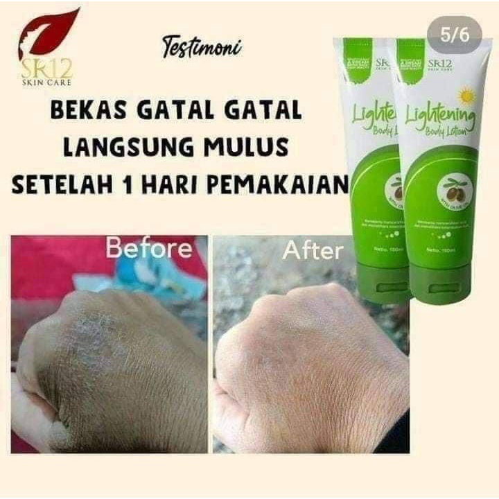 Body Lotion Day Night SR12 Pemutih Badan Hand Body Pencerah Kulit SPF 30+++ Krim Anti Belang Melembabkan Kulit Melindungi Dari Sinar UV