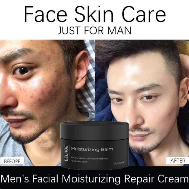 ️️cream pelembab wajah pelembab  acne Krim pelembab revitalisasi pria pelembab pelembab menyegarkan perawatan kulit pelembab mengecilkan pori-pori perawatan wajah