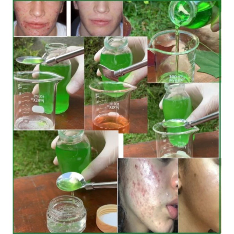 

CENTELLA BOOSTER ACNE ( 500G )