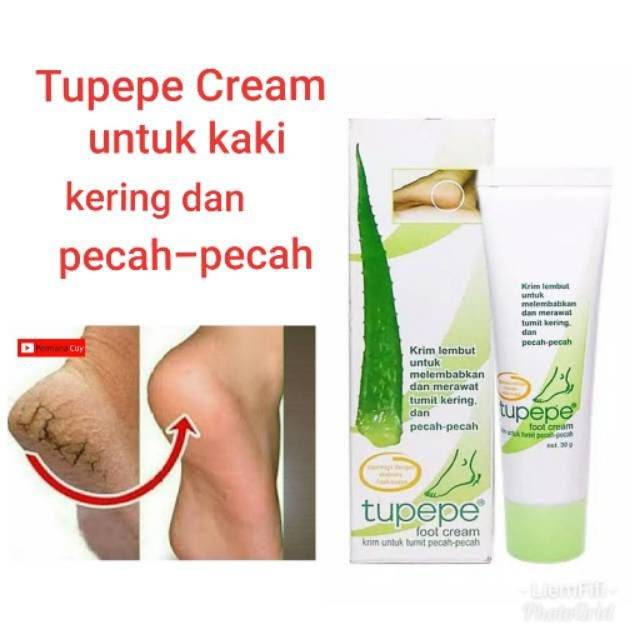 Cream untuk kaki kering dan pecah pecah