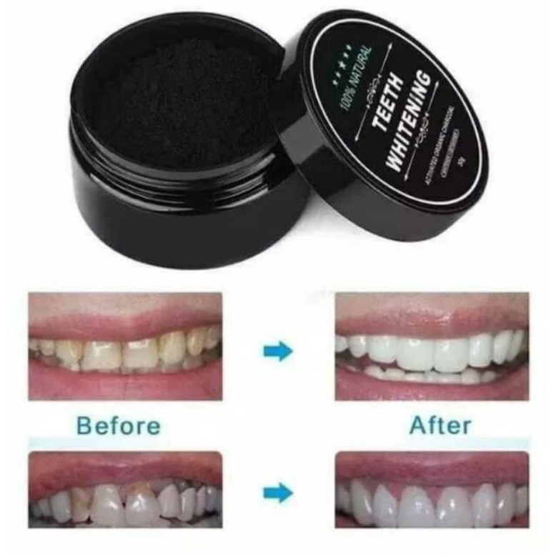 Teeth Whitening Charcoal powder pemutih gigi alami 30g