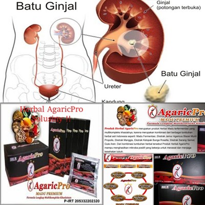 Agaricpro Obat Herbal Penyakit Batu Ginjal Dengan Cepat Aman Dan Ampuh Tanpa Operasi Indonesia