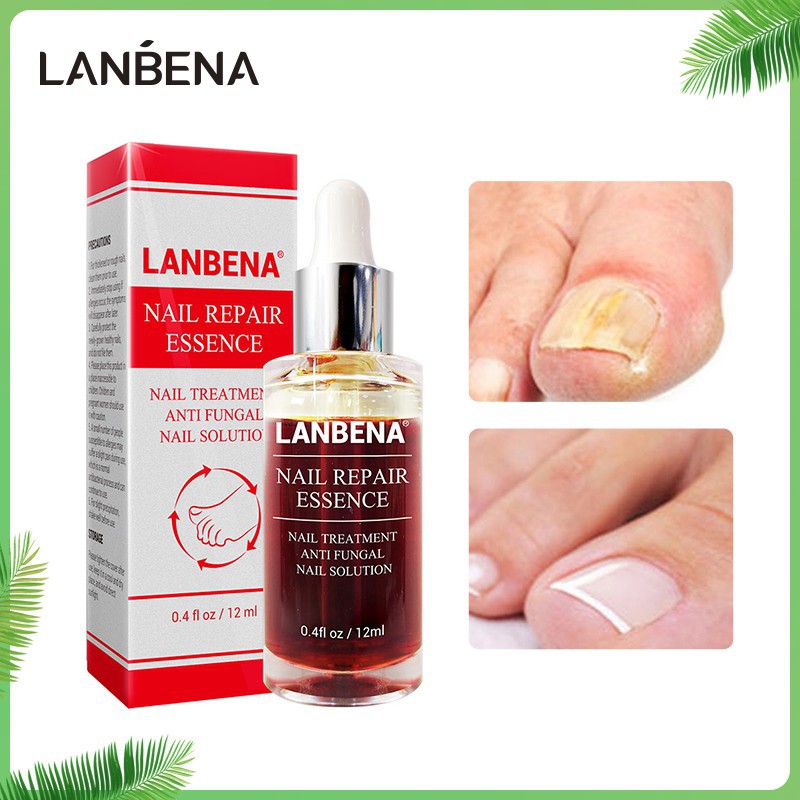 LANBENA NAIL REPAIR ESSENCE OILS SERUM / vitamin kuku anti jamur kapalan nail vitamin fungal