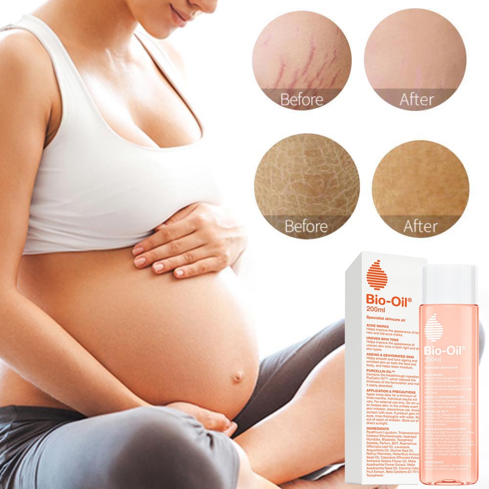 Bio Oil 200ml / Bekas Luka / Strech Mark /  Selulit / Keriput / Selulit Biooil 200Ml