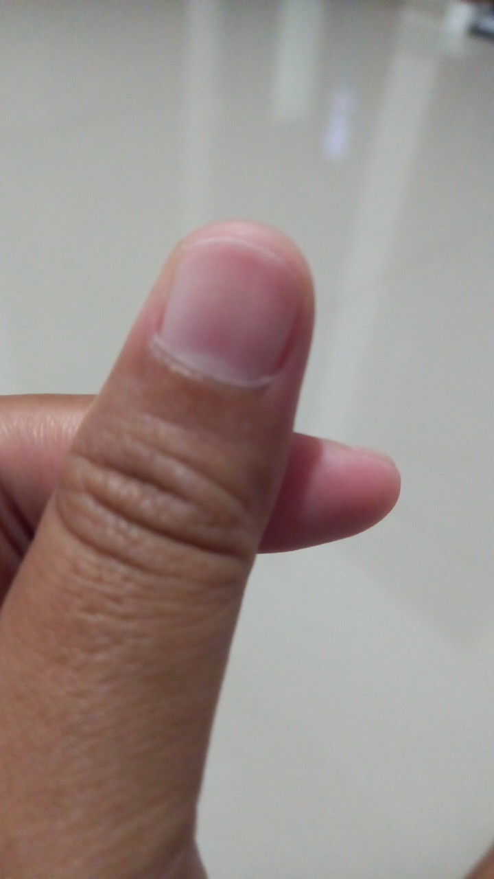 Tempat Sendok Tss1027