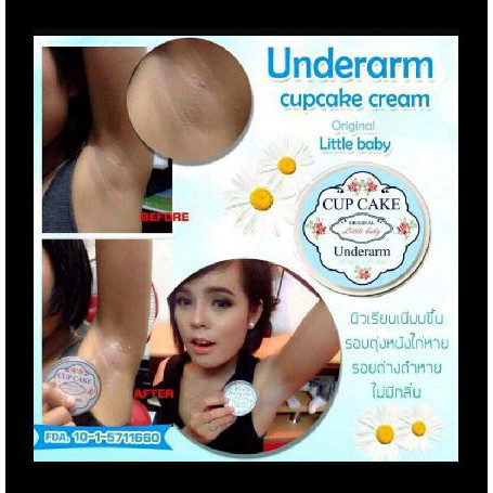

Cupcake Underarm Bergaransi