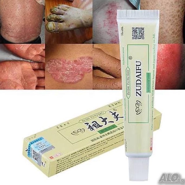 ZUDAIFU SALEP EKSIM OBAT CINA GATAL ORIGINAL SALEP PSOARISIS ROSACEA ANTI BAKTERI