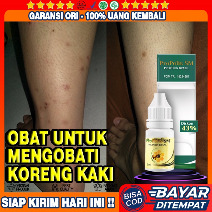 Obat Koreng di Kaki, Obat Koreng Bernanah Untuk Anak, Obat Tetes Untuk Luka Bernanah