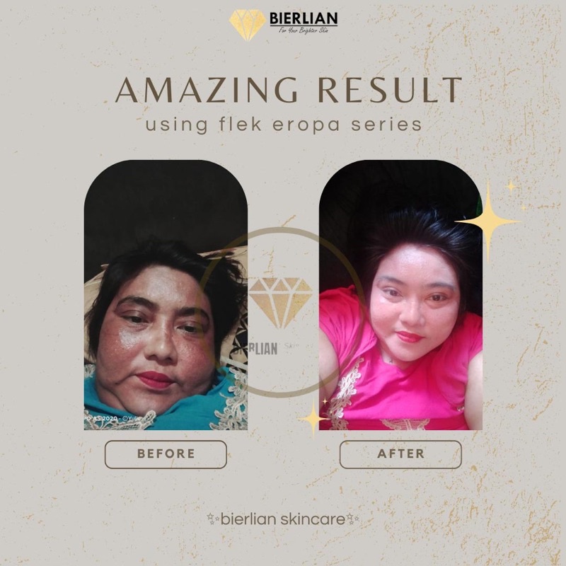 BIERLIAN SKINCARE CREAM WAJAH WHITE GLOW/SUPER WHITE/ACNE/FLEK [Free Pouch+Gift]-5