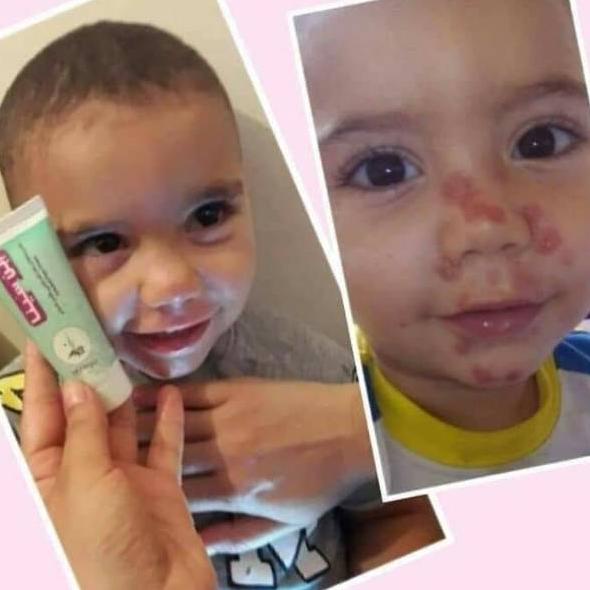 "GMB. 741639" Ibnu Sina my way Cracked feet Cream