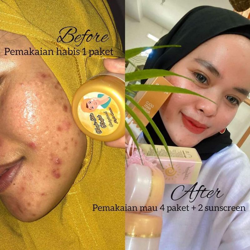 MAGIC SKIN BY RHAJAB BEAUTY ORIGINAL DISTRIBUTOR JAKARTA BARAT