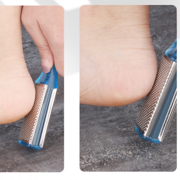 Mysterygirl - Alat Penghalus Tumit Kapalan Telapak Kaki Pedicure Foot Tools Perawatan Lainnya Pedicure Amplas Pengangkat Kulit Mati