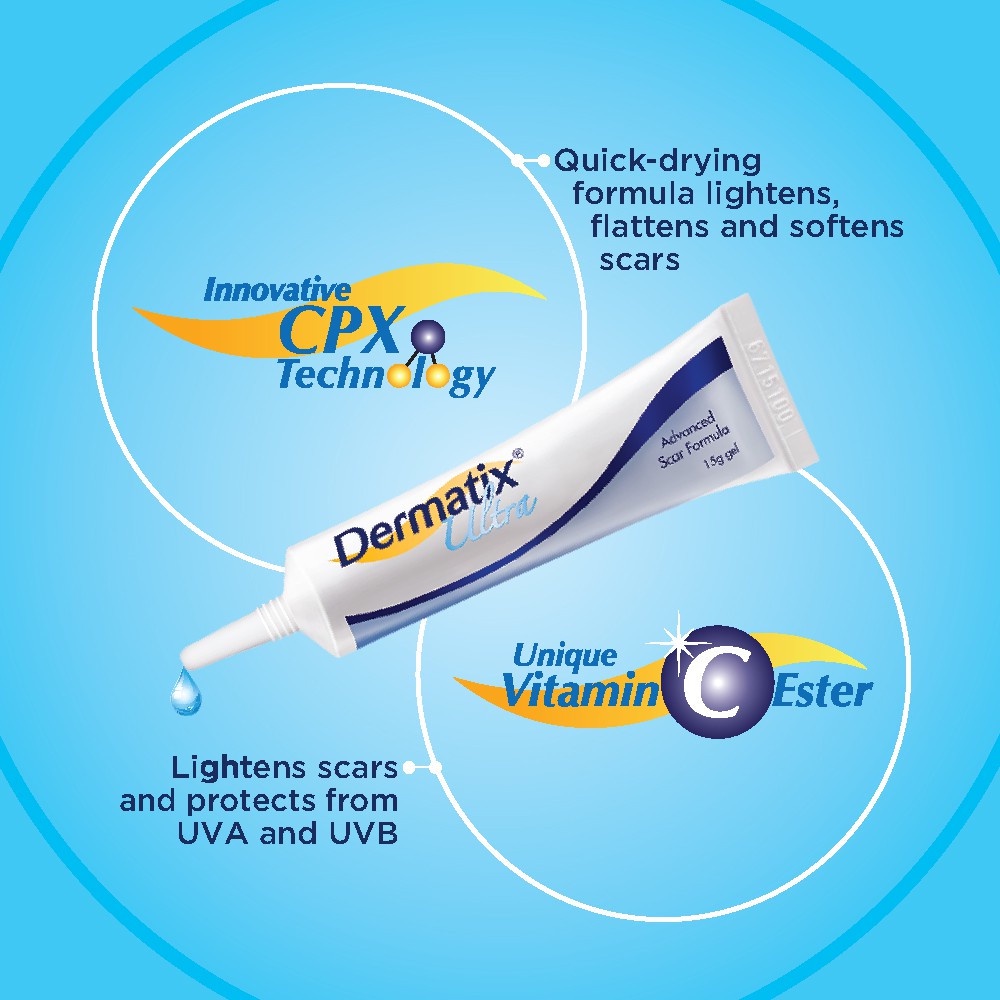 Dermatix Ultra Advanced Scar Formula Gel Cream Salep Penghilang Bekas Luka / Keloid ANTI SCAR Cream Krim Digigit Serangga Nyamuk Luka Bakar Stretchmark Stretch Mark 15gr Operasi Oprasi Iris Tergores Jerawat Gatal Hitam Ampuh
