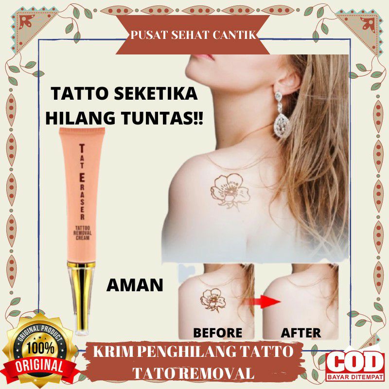 Penghilang, Penghapus Tatto Removal Tatto