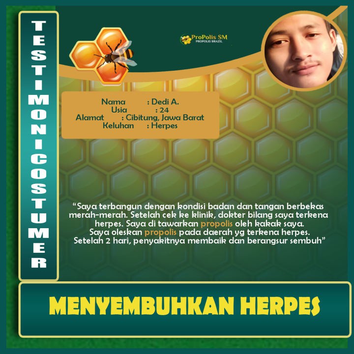 Obat Untuk Memutihkan Selangkangan Yang Hitam, Pemutih Selangkangan Hitam, Gatel Selangkangan, Obat Gatal Selangkangan - Propolis SM 100% Original-4