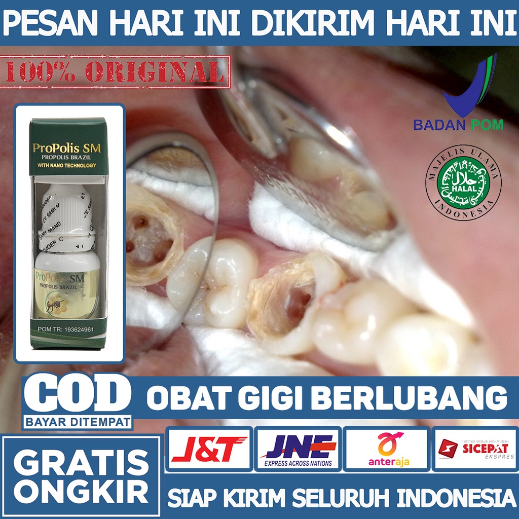 Jual Obat Gigi Berlubang - Gigi Berlubang Hitam - Gigi Berlubang Tumbuh