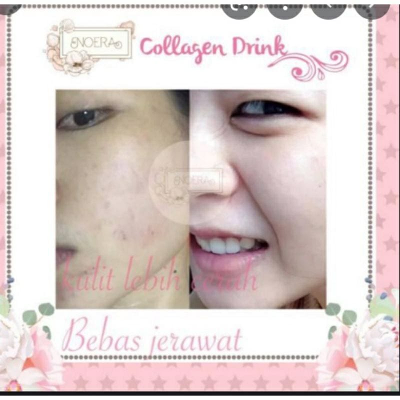 Noera Collagen Drink - Suplemen Pemutih Kulit Noerabeautycare Noera Drink Me Collagen BPOM