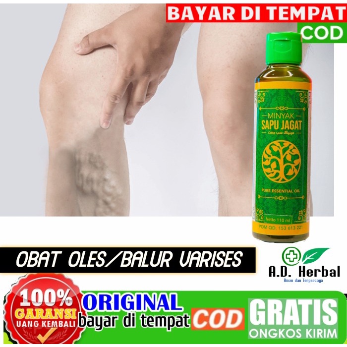 Jual Promo Obat Balur Minyak Oles Varises Di Kulit Tradisional Parises Di Kaki Indonesia Shopee Indonesia