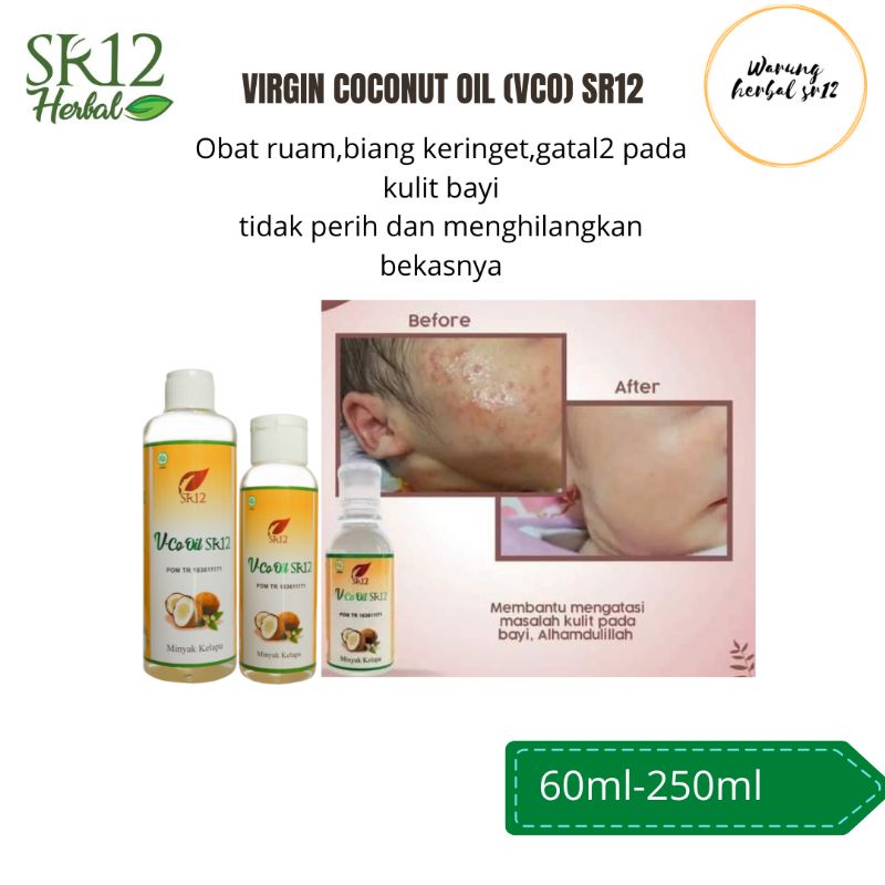 VCO OIL SR12 UNTUK BAYI atasi ruam sembelit biang keringat gatal bisa diminum