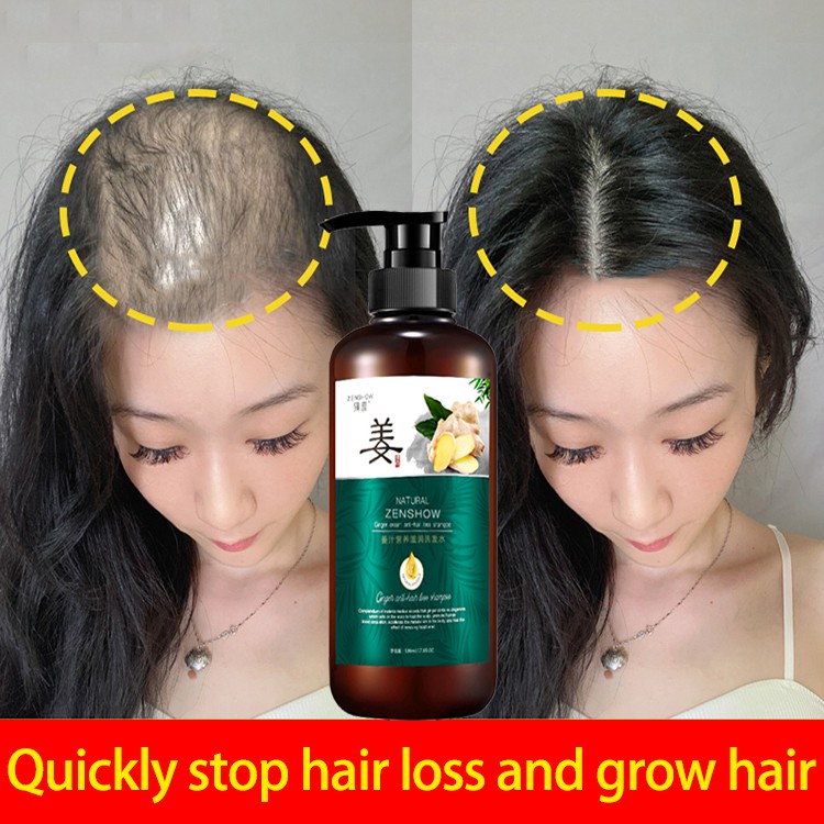 sampo penumbuh rambut Shampo Penumbuh Rambut Cepat Serum Rambut 500ml Rontok Botak Rontok Penumbuh Rambut Perawatan Hair Care Treatment Anti Rambut Rontok