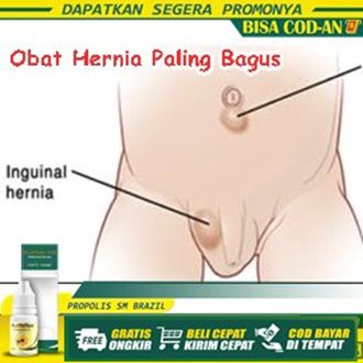 Obat Hernia Turun Berok, Usus Turun - Propolis SM