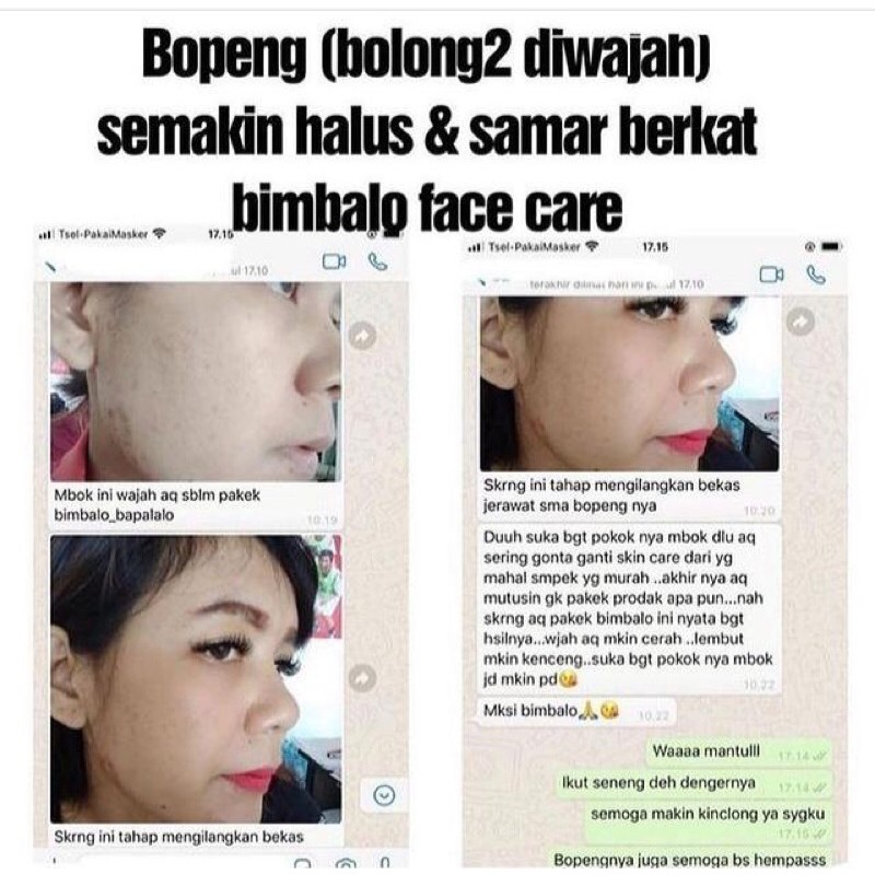 Paket facecare/skincare bimbalo bapalalo