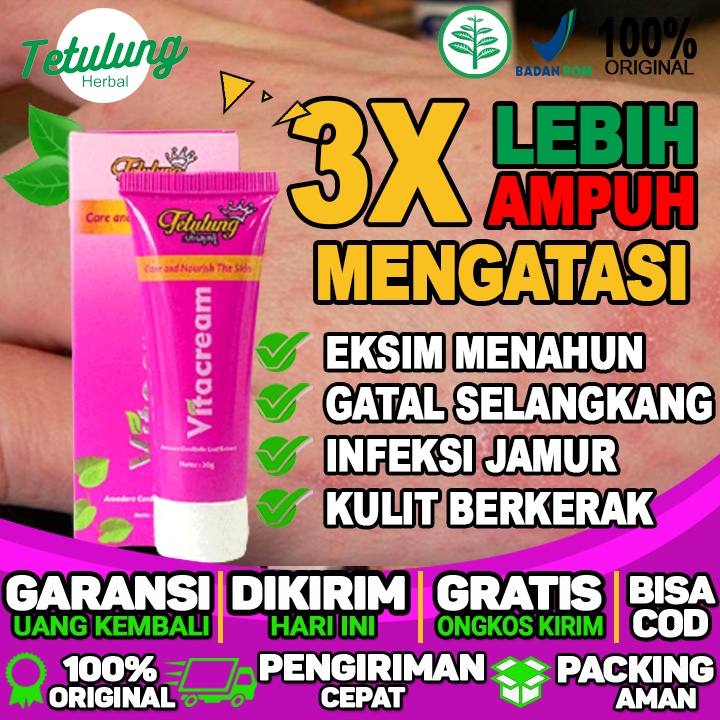 Obat Bisul Oles  Obat Obat Bisul  Obat Bisul Pada Bayi  Obat Bisul Pecah Obat Eksim Menahun Yang Amp